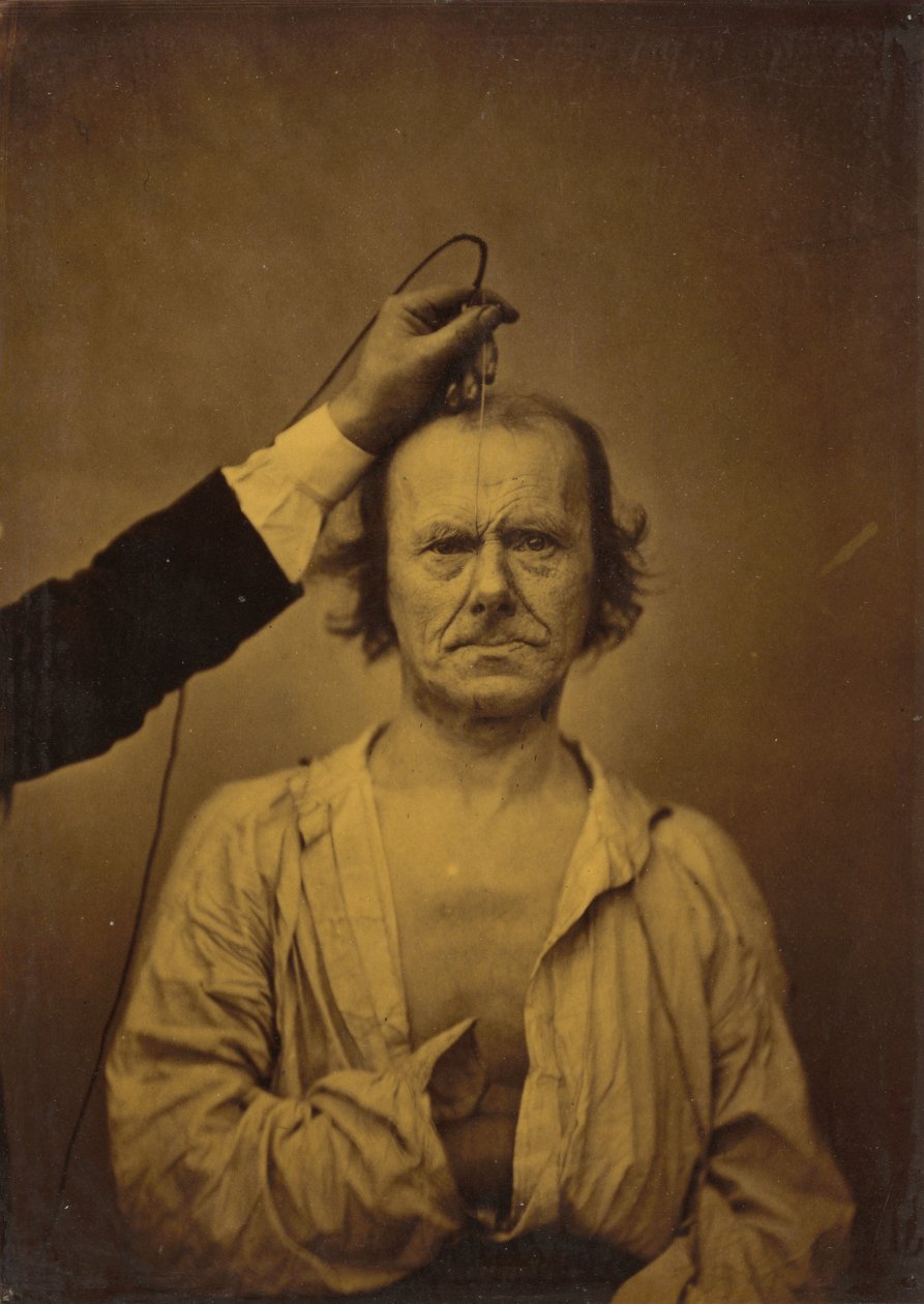 Dikkat (solda); Şiddet, saldırganlık (sağda) by Guillaume Benjamin Amant Duchenne
