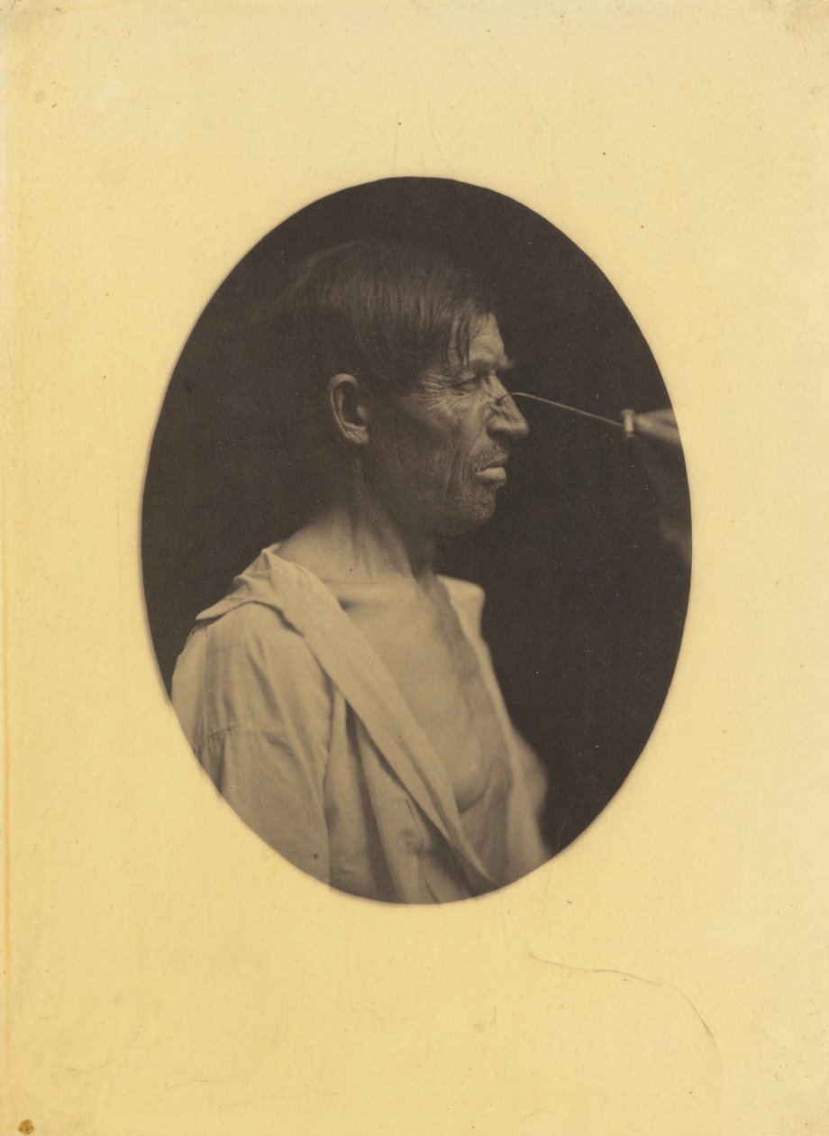 Kötü mizah, hoşnutsuzluk by Guillaume Benjamin Amant Duchenne