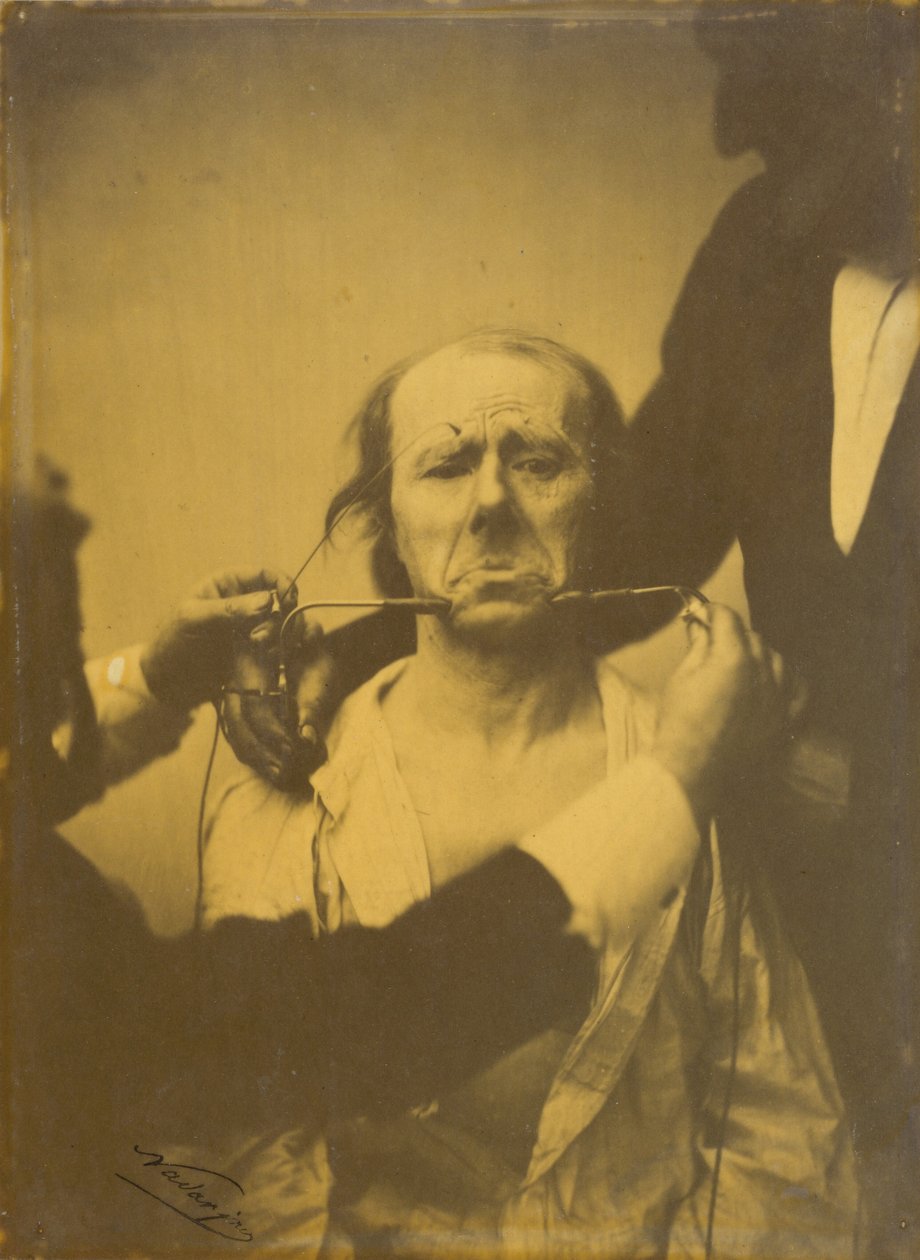 Acı ve umutsuzluk by Guillaume Benjamin Amant Duchenne