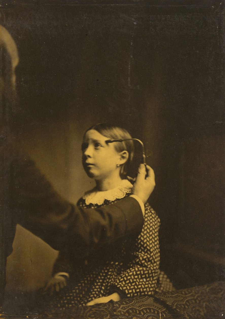 Acılı hatıralar by Guillaume Benjamin Amant Duchenne
