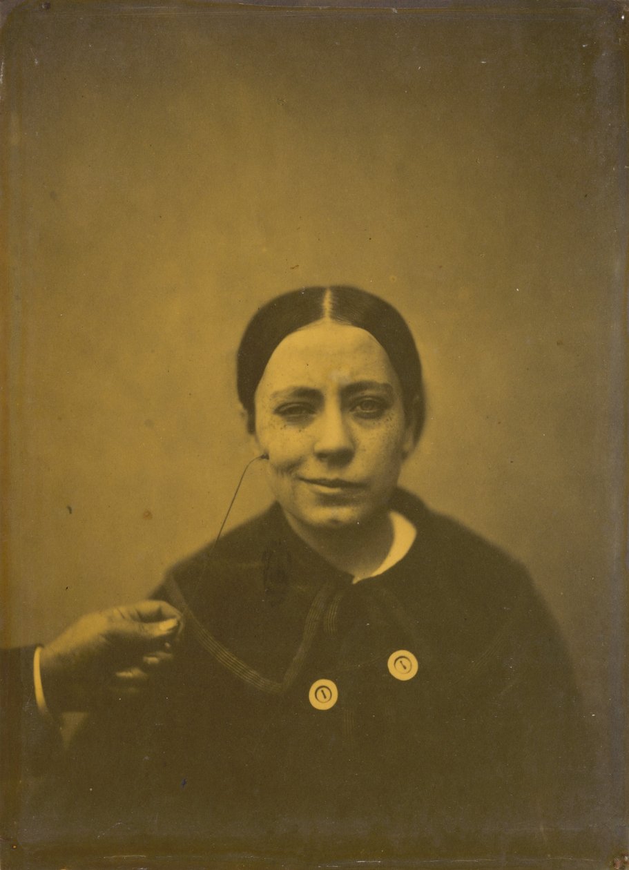 Depresyona bağlı olarak ağız açısının hafif alçalması (solda); Sahte kahkaha (sağda) by Guillaume Benjamin Amant Duchenne