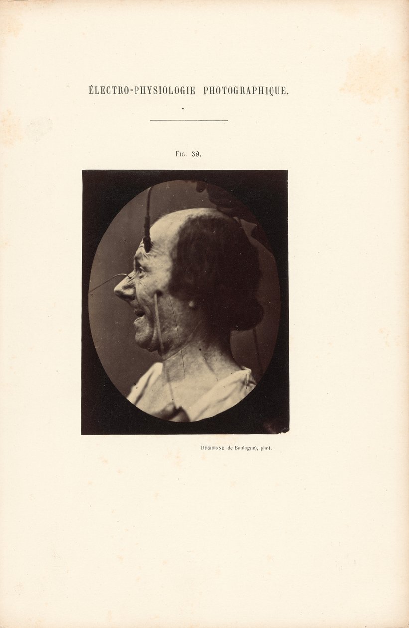  by Guillaume Benjamin Duchenne