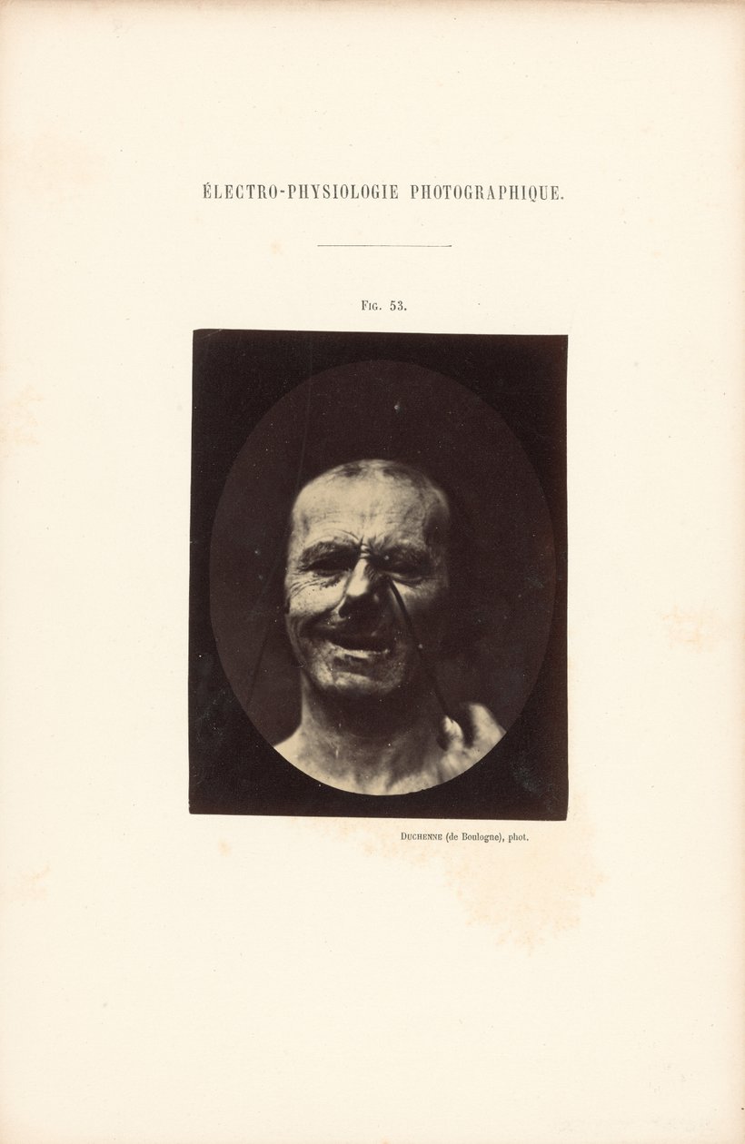  by Guillaume Benjamin Duchenne