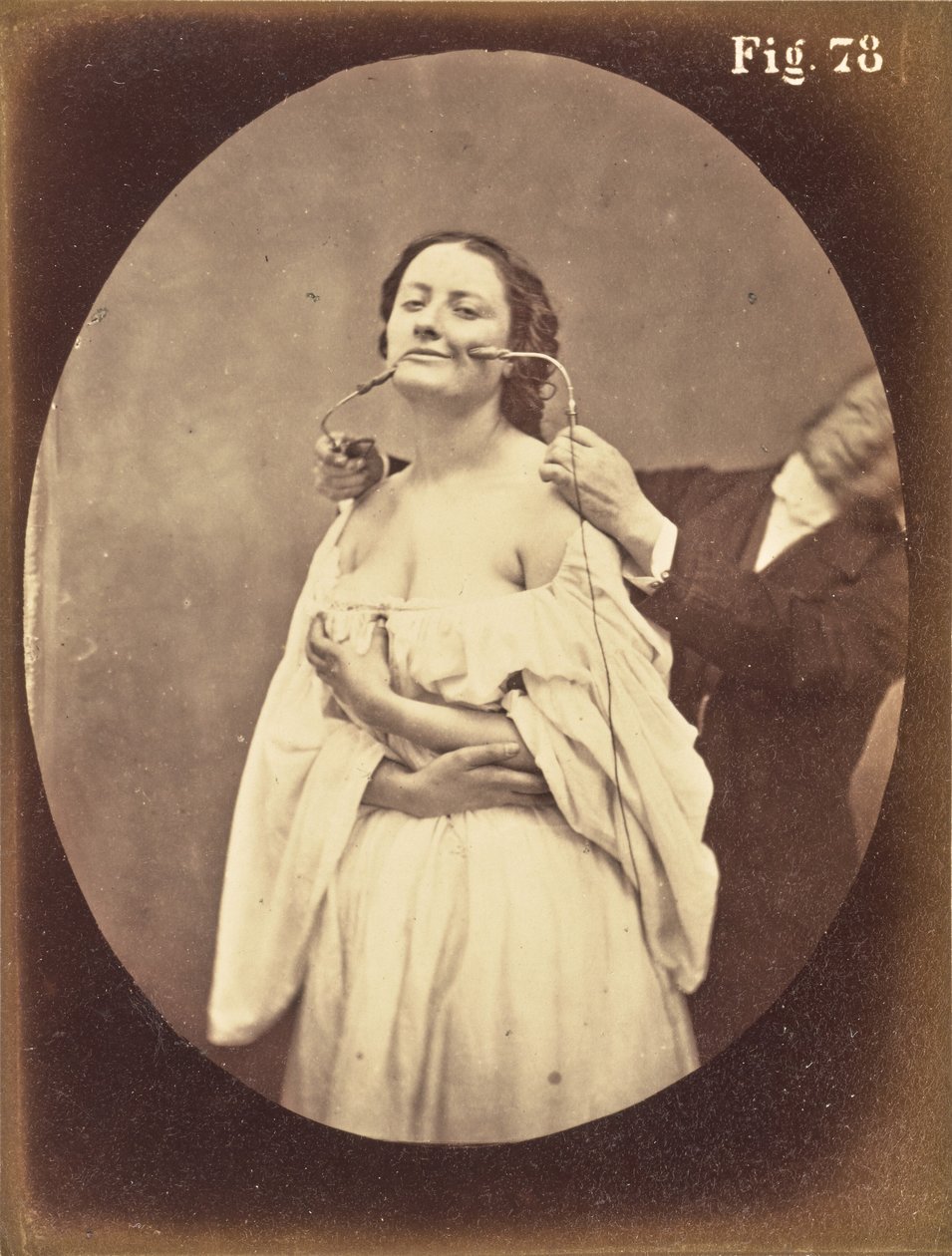  by Guillaume Benjamin Duchenne