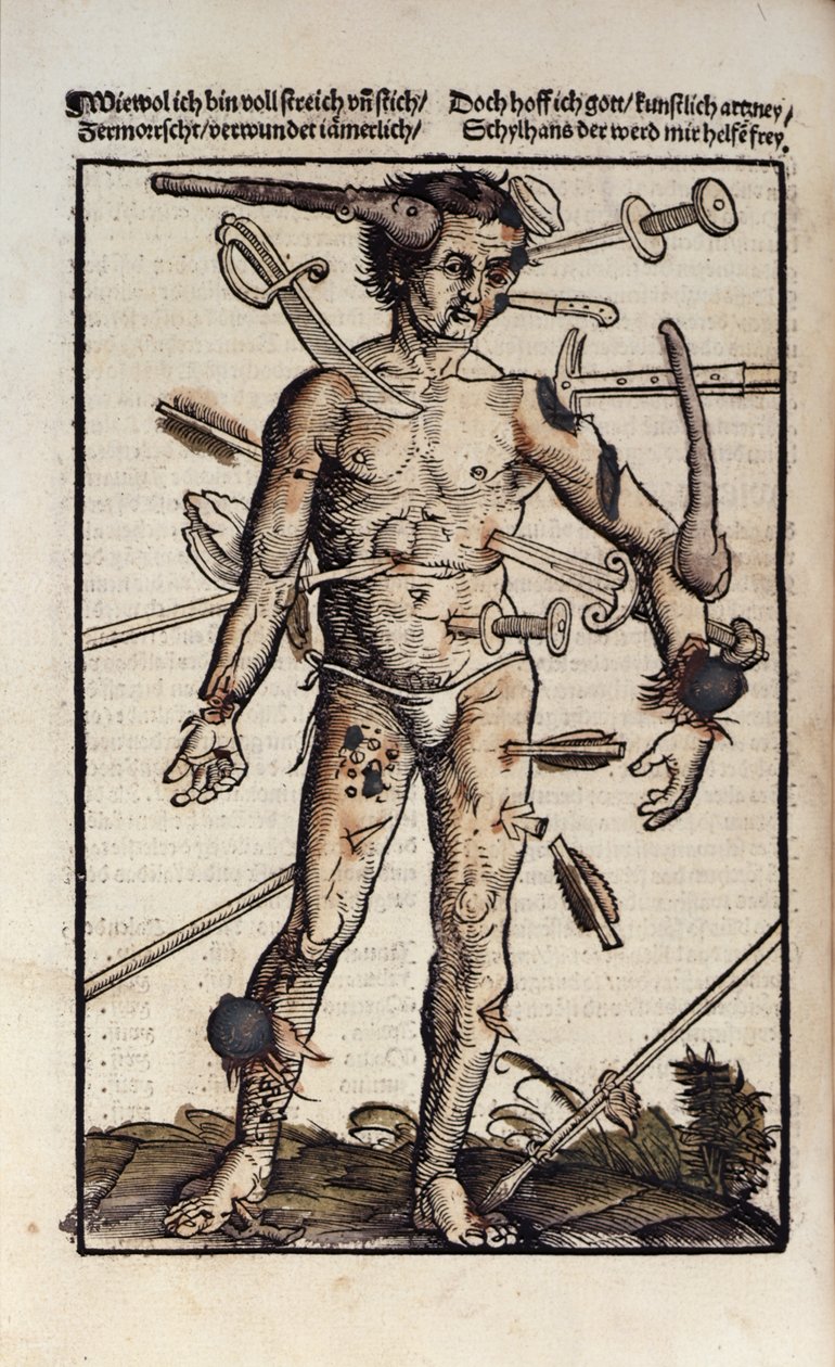 XVIIIv Yaralı Adam, Hans von Gersdorff