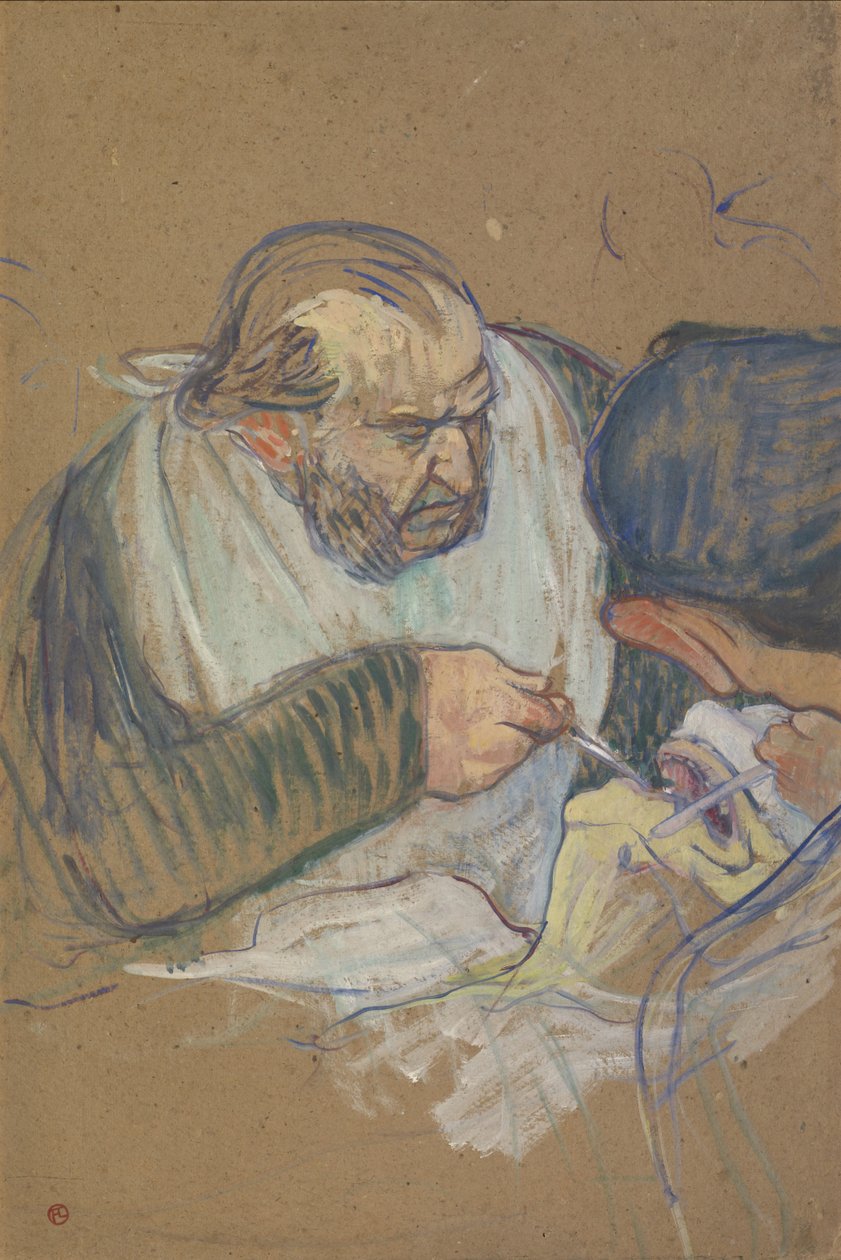 Dr. Péan Operasyon, 1891-92 by Henri de Toulouse Lautrec