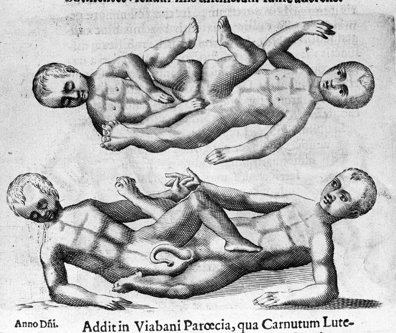 Farklı insan canavar türleri: Pelvis ile birbirine bağlanan Siyam çocukları. İtalyan bilim adamı Fortunio Liceti (1577-1656) tarafından "De monstrorum natura, causis et Differentiis" adlı gravür. 1646 by Italian School