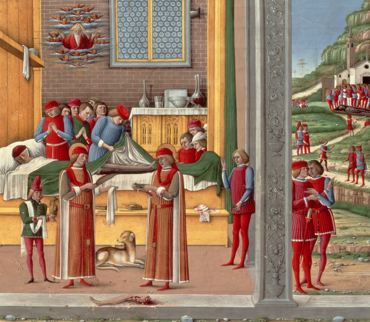 Ortaçağ ampütasyon sahnesi (panelde sıcaklık) by Italian School
