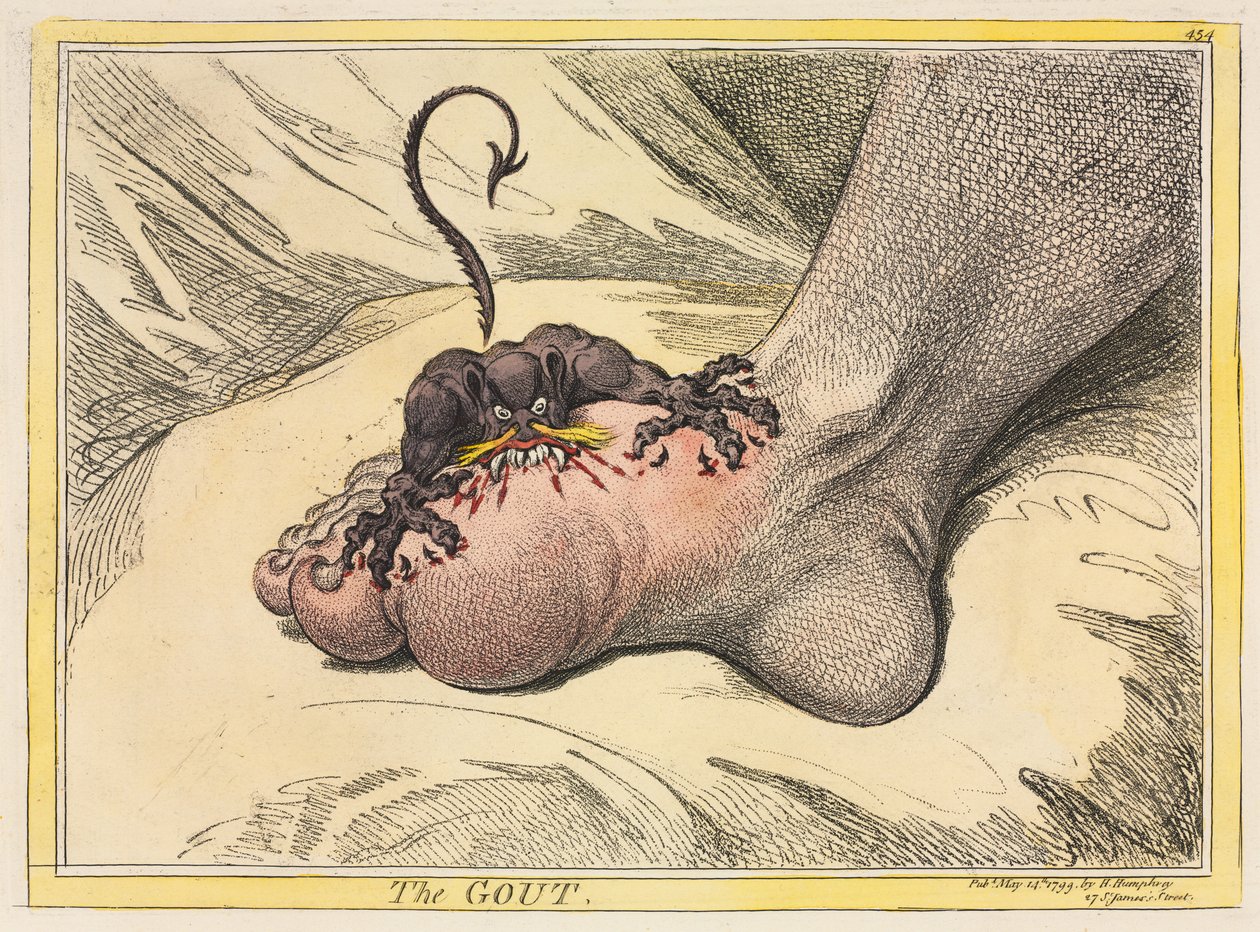 Gut, 1799. by James Gillray