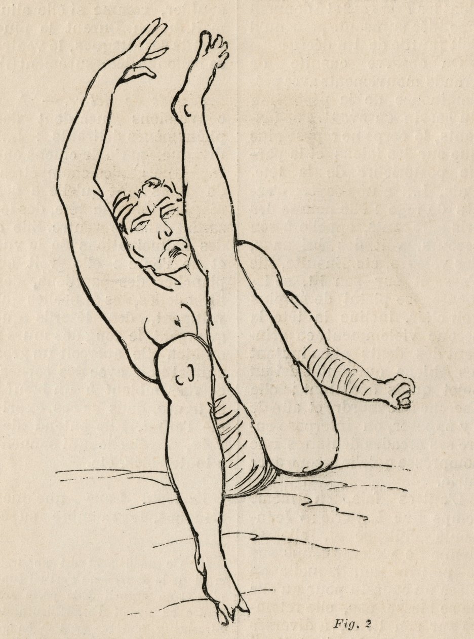 Histerik epilepsi, atak, bükülmeler, şek. 2, Bourneville et P. Regnard, Paris, 1876 tarafından 