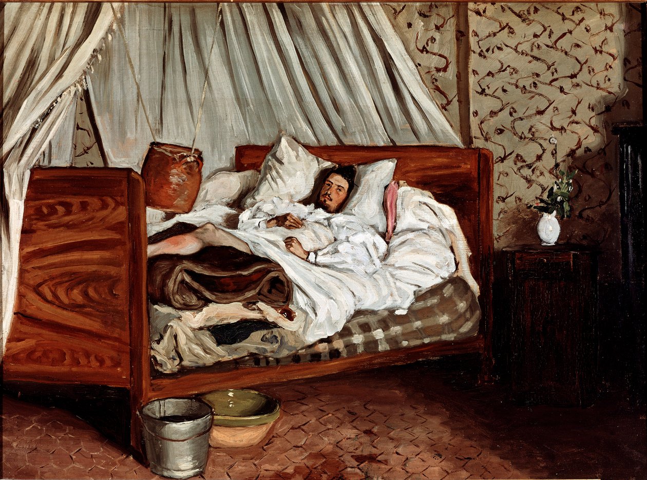 Doğaçlama ambulans (Claude Monet yaraları). Jean Frederic Bazille