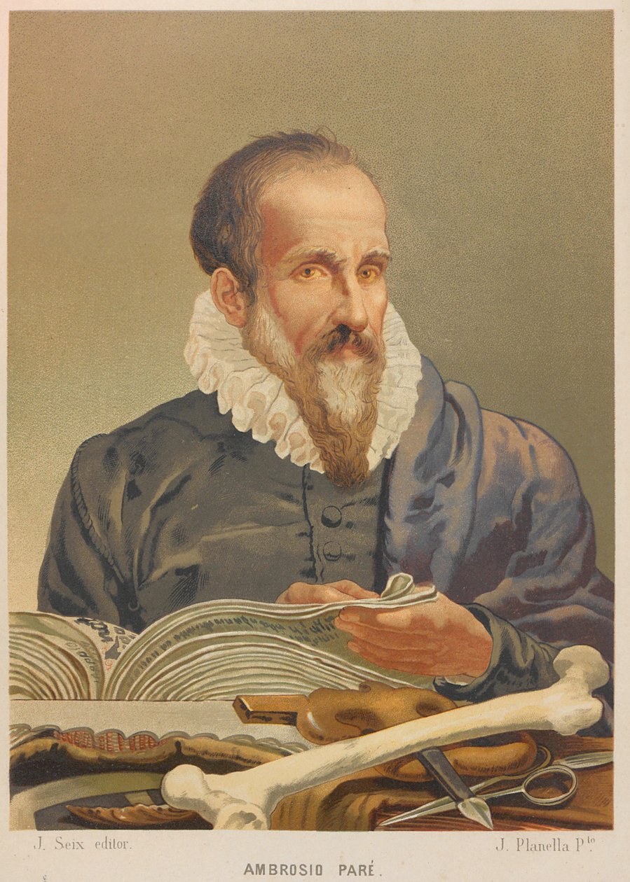 Ambroise Paré