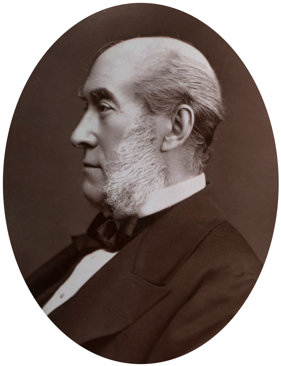 Sir William Fergusson, Bart, FRS, Kraliçeye Çavuş-Cerrah, 1877. by Lock and Whitfield