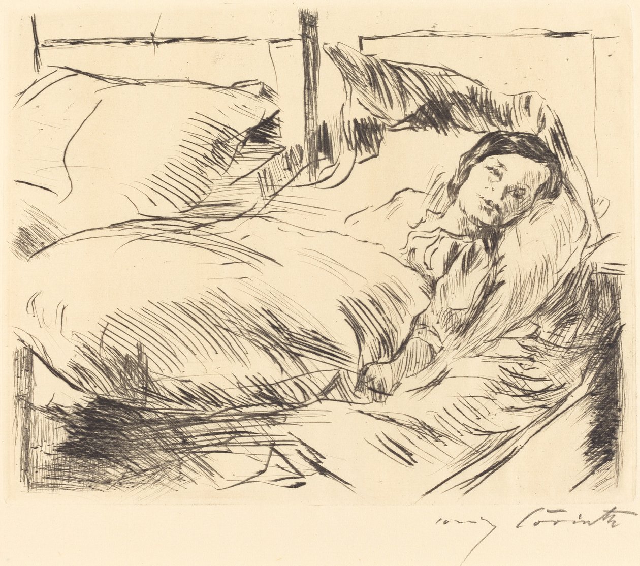 Hasta Çocuk Hasta Çocuk, 1918. by Lovis Corinth