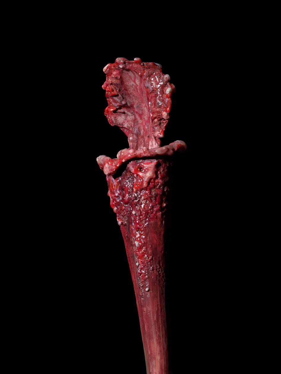  by Mat Collishaw