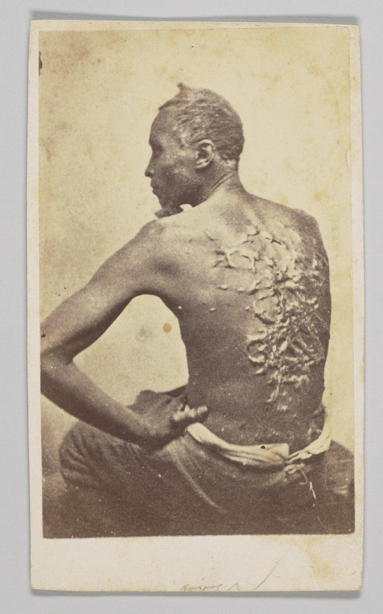 Gordon Tıbbi Muayene Altında, 1863. by McPherson and Oliver