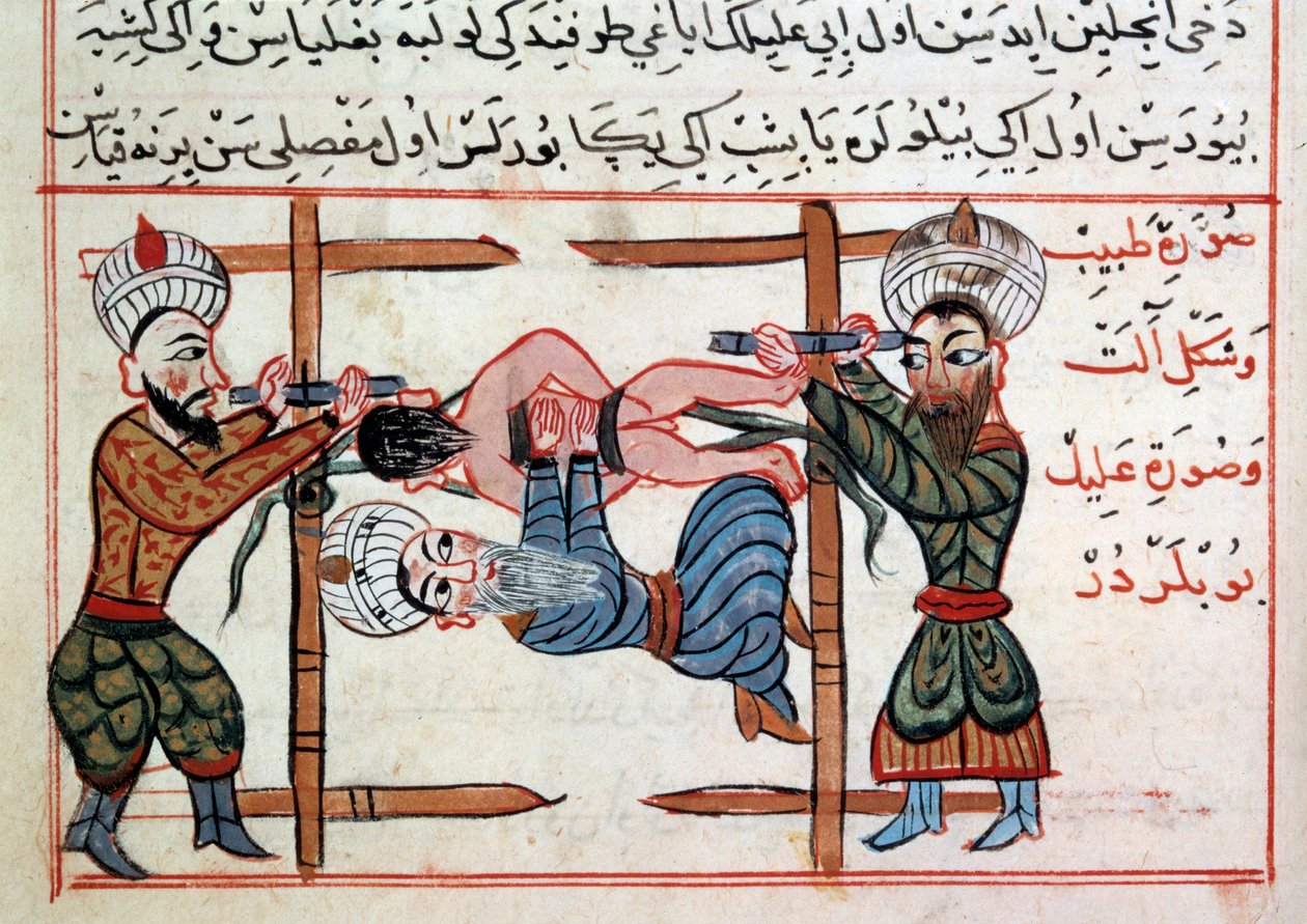 Kırığın azaltılması. Şerefeddin