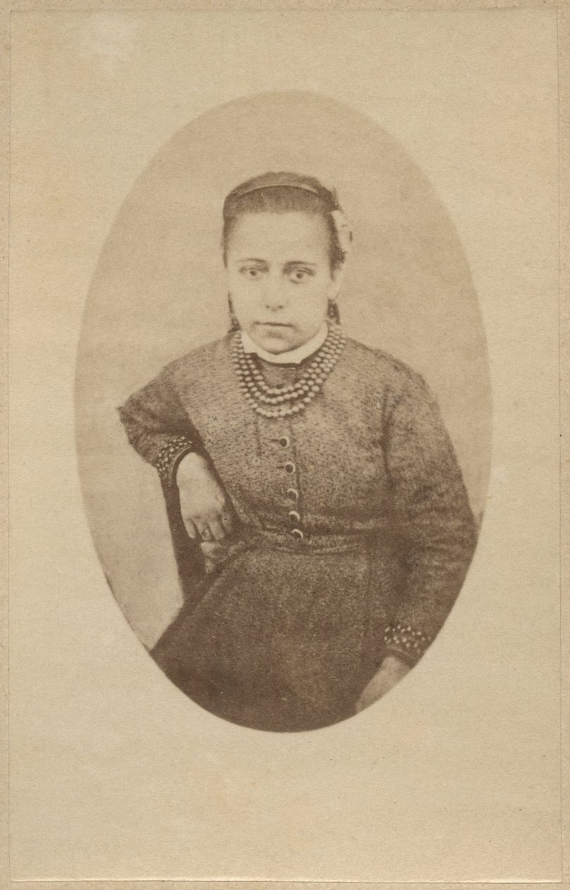 Histeri, normal görünüm, Bourneville ve P. Regnard