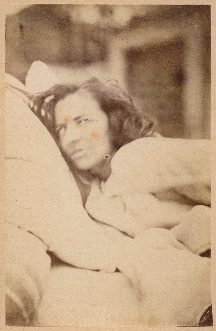 Histerik epilepsi, deliryum, şehvet, levha XXXVI, Bourneville ve P. Regnard, Paris, 1876 (albüm baskısı) 