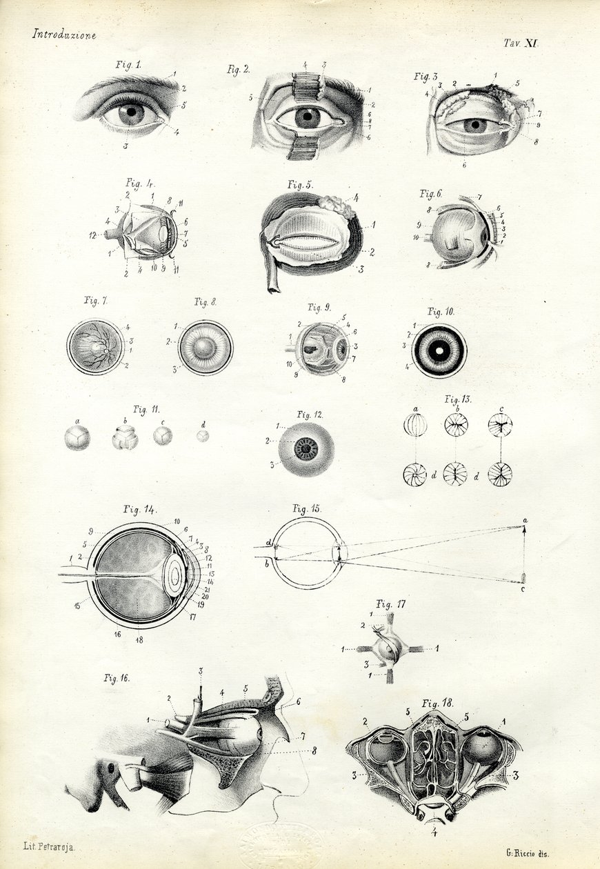 Görme Organı, 1863-79 by Raimundo Petraroja