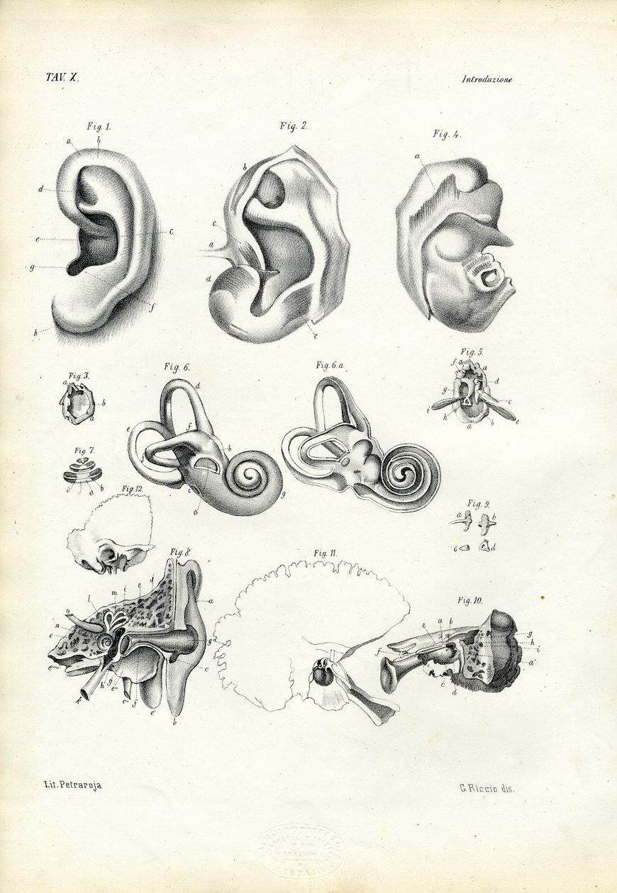 İşitme Organı, 1863-79 by Raimundo Petraroja