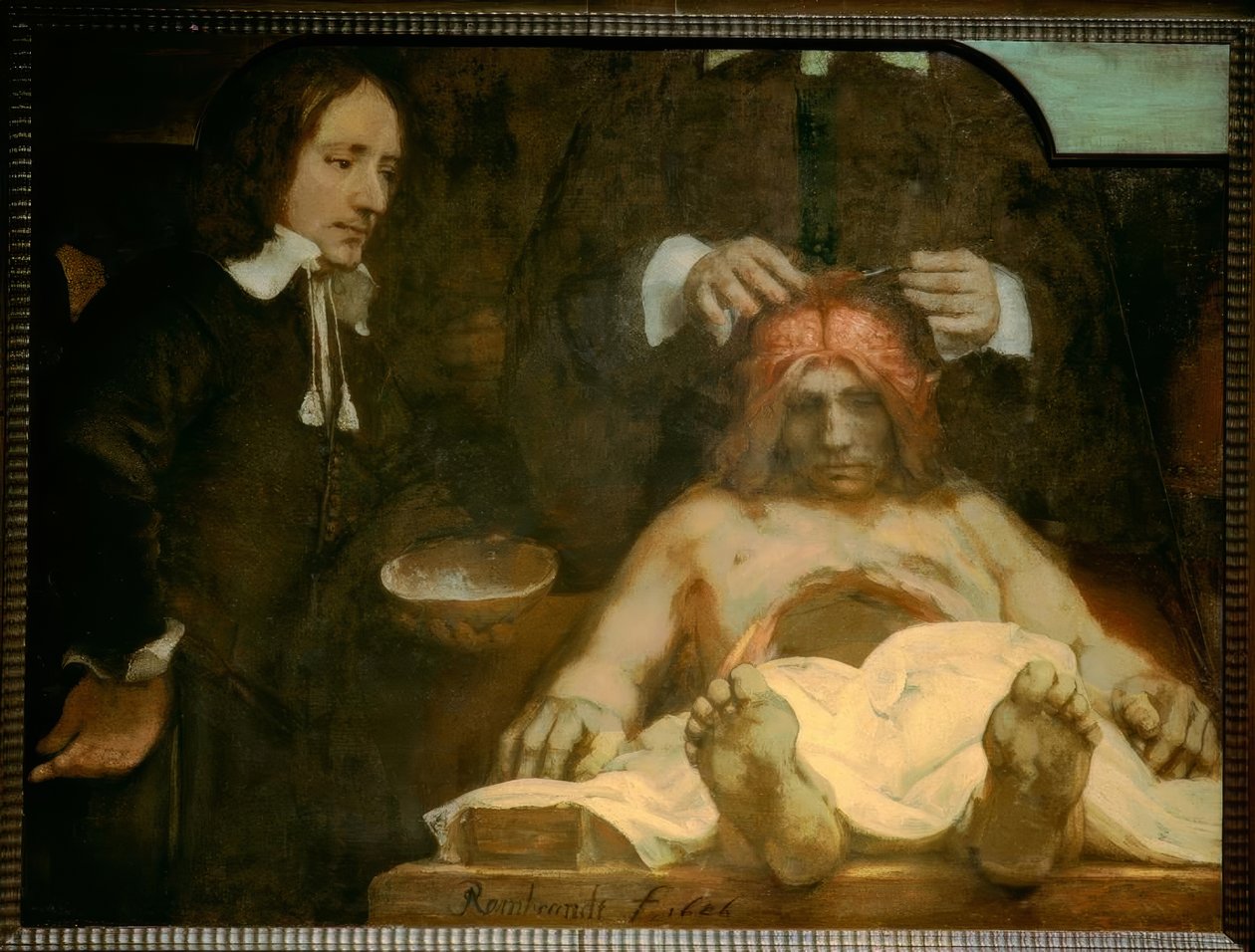 Dr. anatomisi Johan Deijman by Rembrandt van Rijn