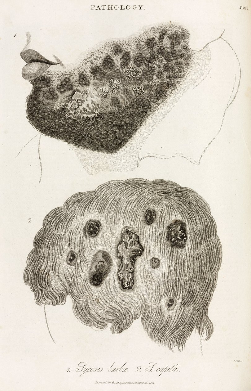 Dermatoloji Cilt hastalıkları by John Pardon