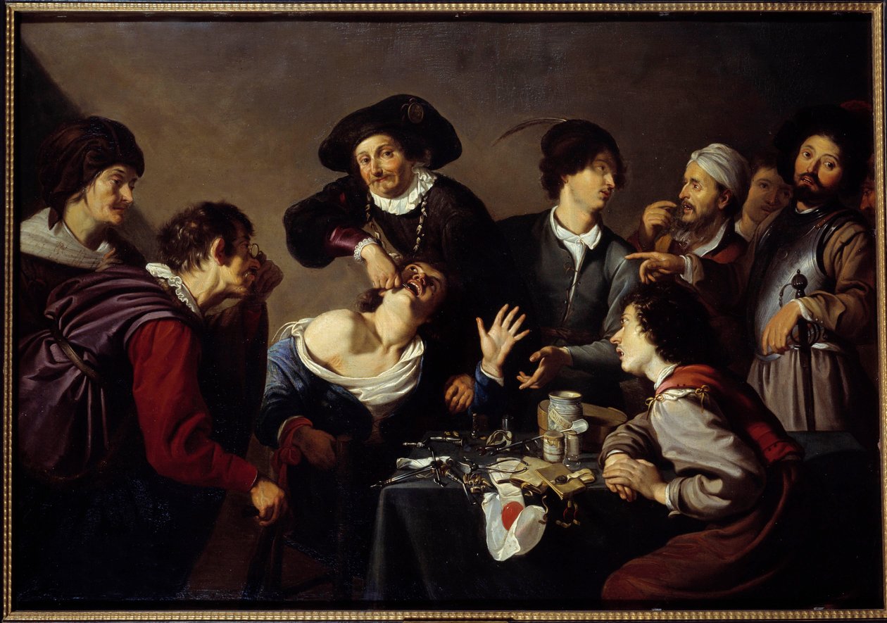 Diş Çıkarıcı Bir diş hekimi asistanlarının etrafını sarar ve aletler bir hastanın dişini yırtar. Theodore Rombouts tarafından yapılan tablo by Theodor Rombouts