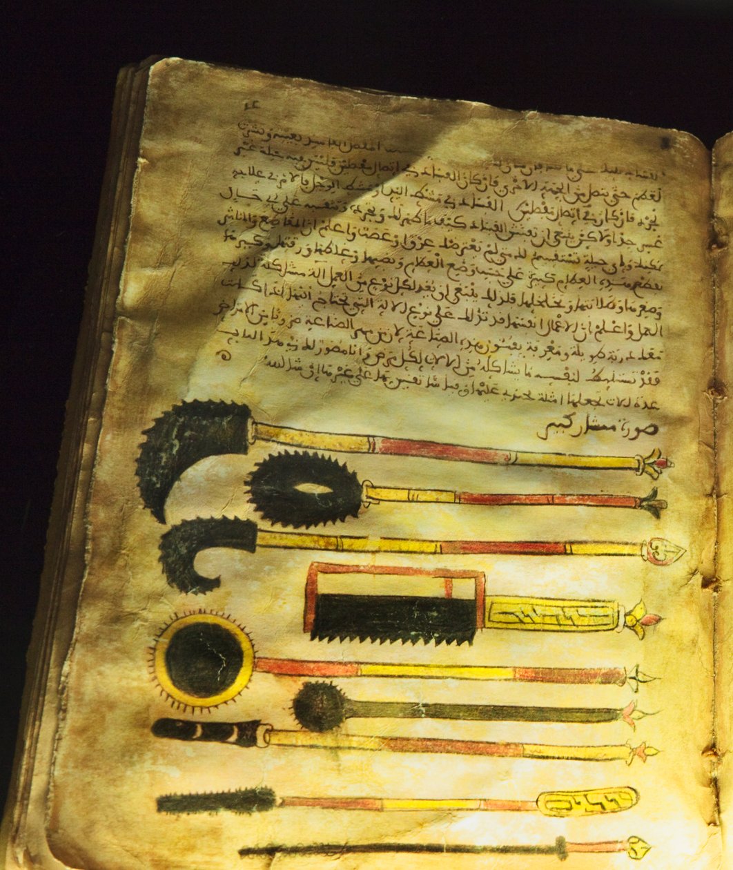 Ebu al-Qasim al-Zehrawi