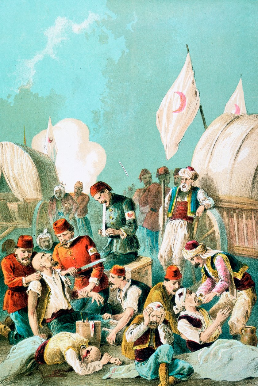 Anestezi uygulanmadan kesilen kol, Rus-Türk Savaşı, 1877 by Unbekannt