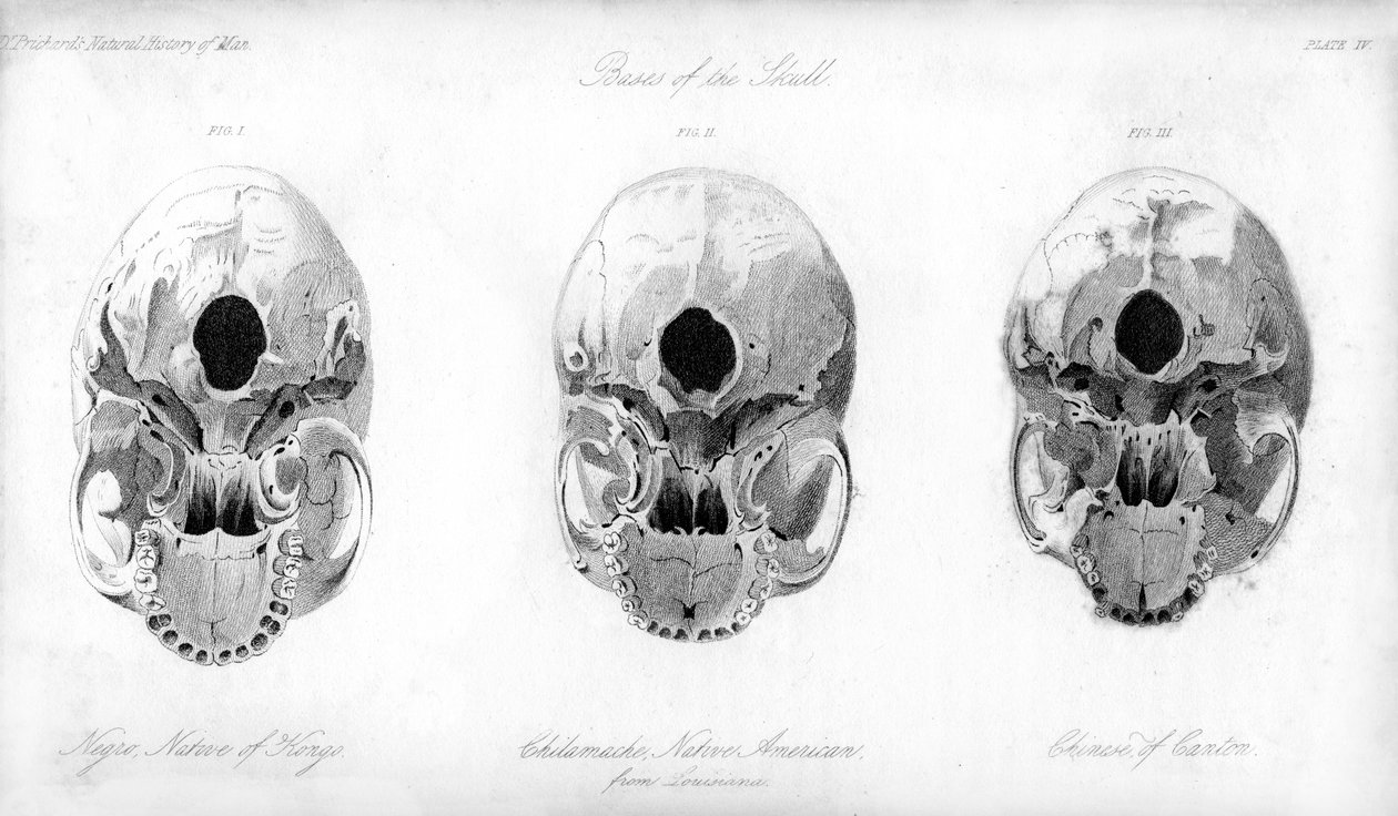 Kafatasının tabanı, 1848 by Unbekannt