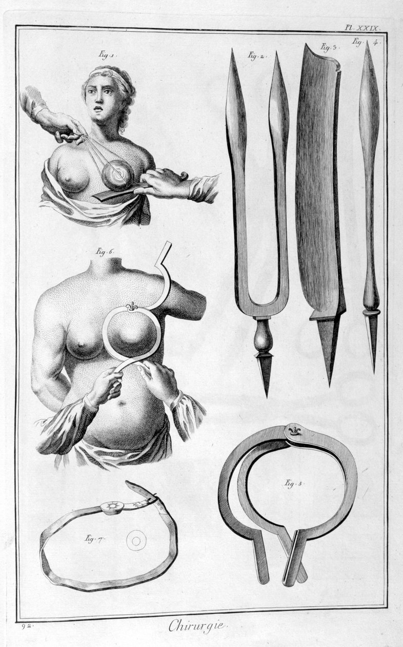 Göğüs cerrahisi, 1751-1777 by Unbekannt