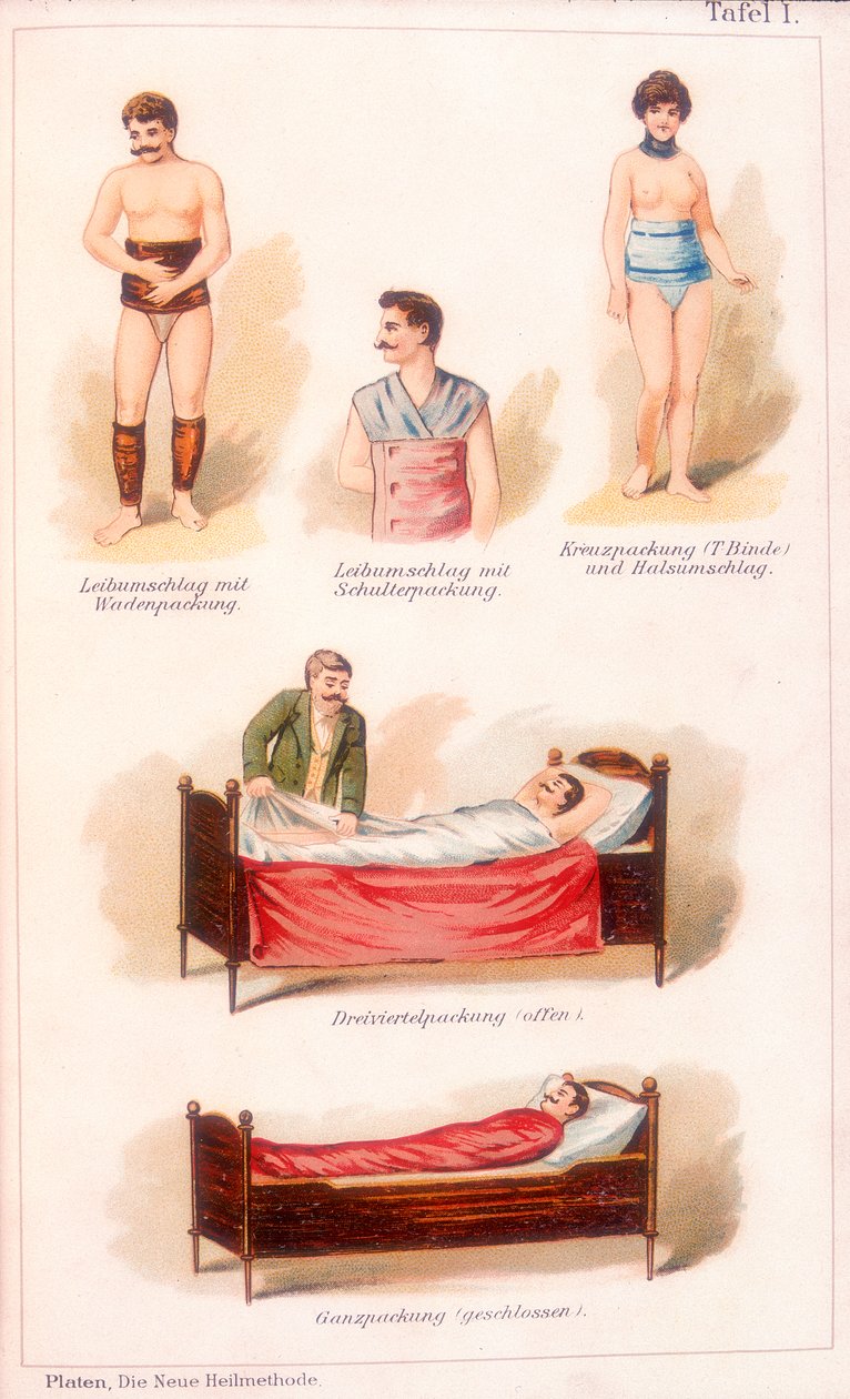 Hidroterapi tedavileri, c1902 by Unbekannt