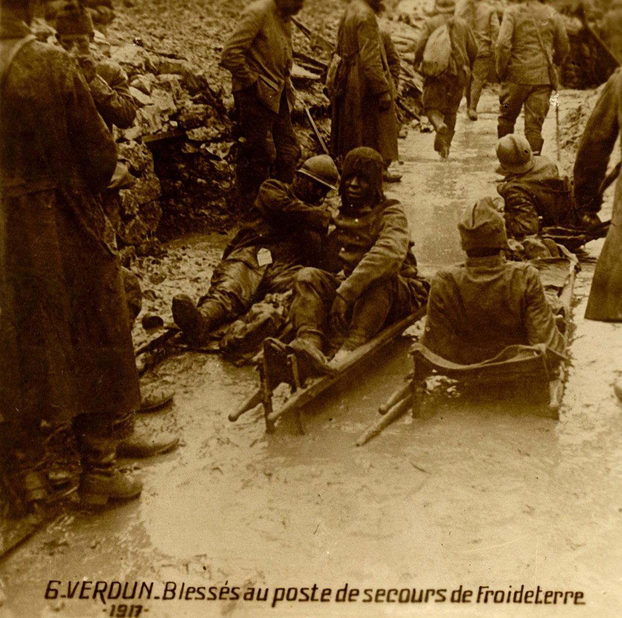İlk yardım noktasında yaralı askerler, Froideterre, Verdun, Kuzey Fransa, 1917 by Unbekannt