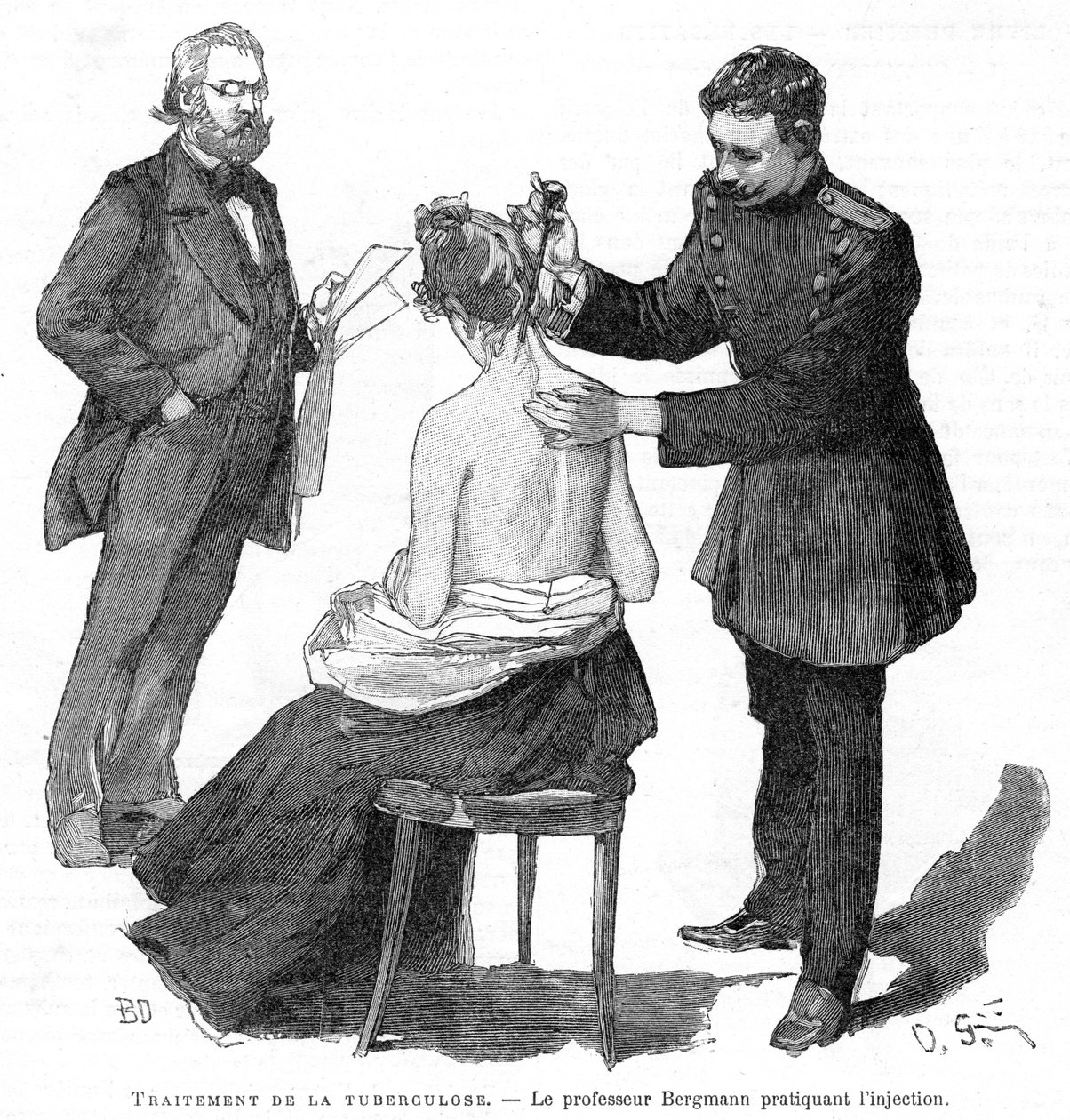 Profesör Bergmann bir tüberküloz hastasını enjekte ediyor, 1891 by Unbekannt