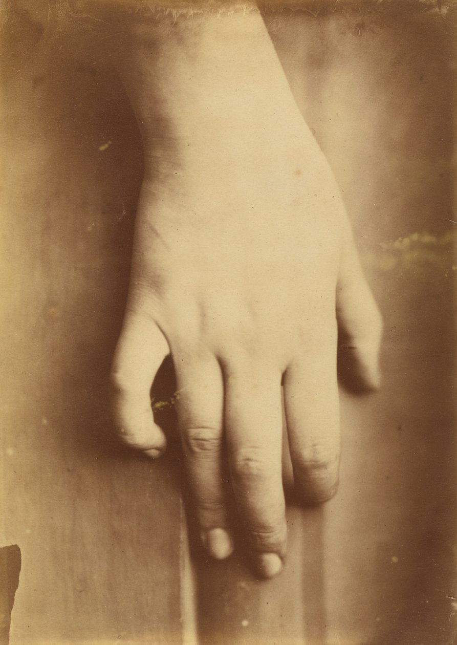 Bir Elin İncelenmesi, 1865. by Unbekannt