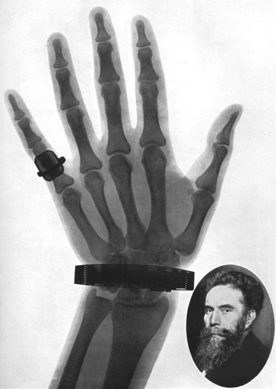 Bir elin röntgen fotoğrafı, 1926 by Unbekannt