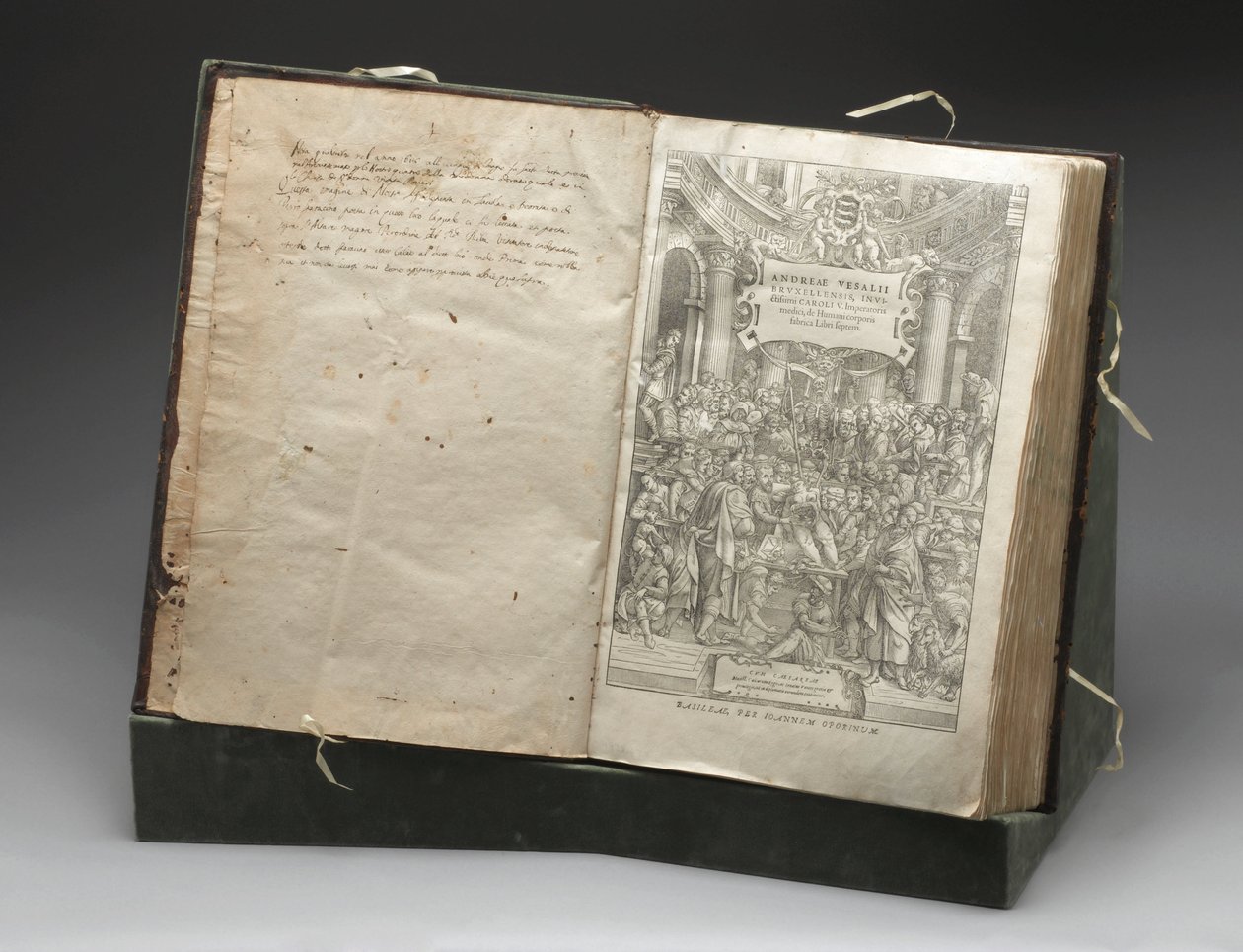 Patoloji, Diseksiyonlar Andreas Vesalius
