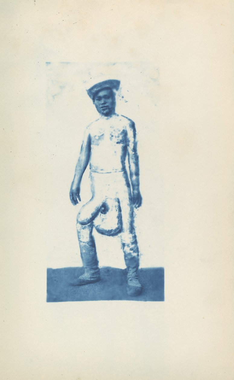 fil hastalığı by Unknown 19th Century