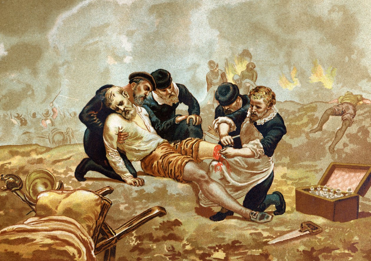 Ambroise Pare Medicine ve Fransız cerrah (c. 1509-1590) amputasyondan sonra arterlerin ligasyonu yapıyor. hombres ve Mujeres ünlülerinden sonra. Barselona 1877. by Unknown artist