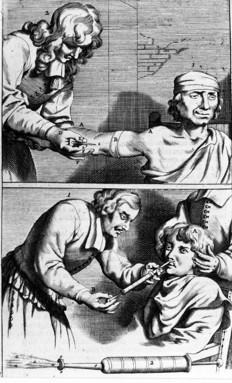 Johannes Sculpteti tarafından kanama ve burun duşu “” Armamentarium Surgery” Amsterdam 1672 by Unknown artist