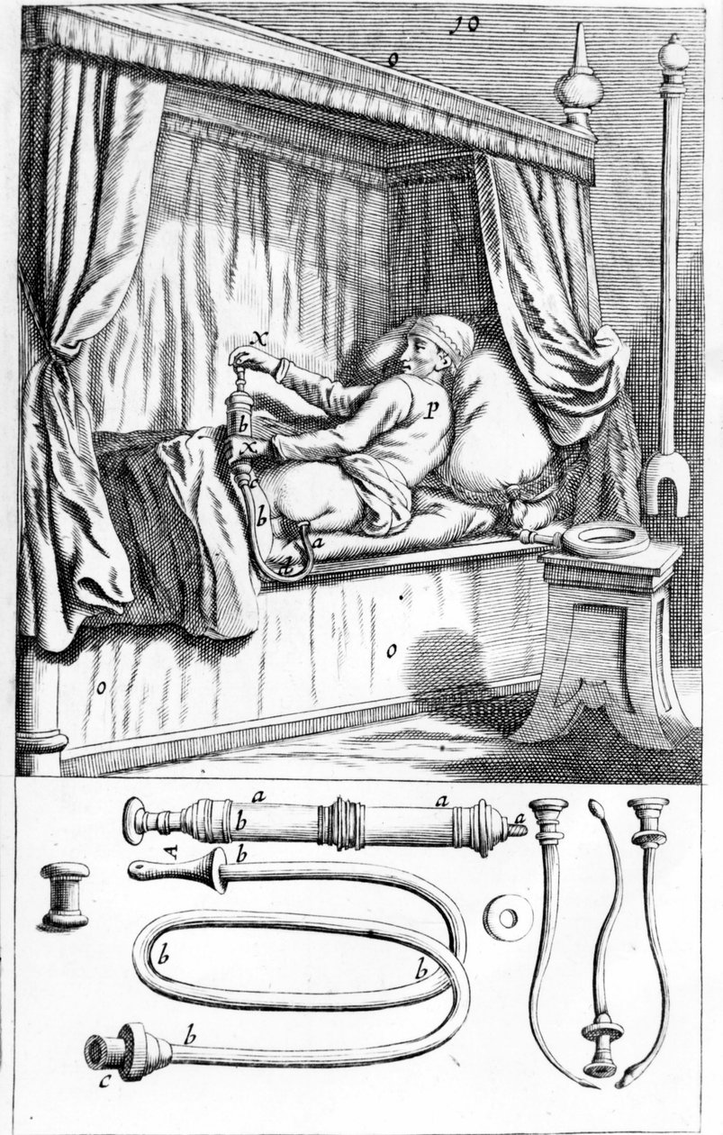 Clystère (lavmanlar için) Johannes Sculptetus “” Armamentarium Surgical””. Venedik 1665 by Unknown artist