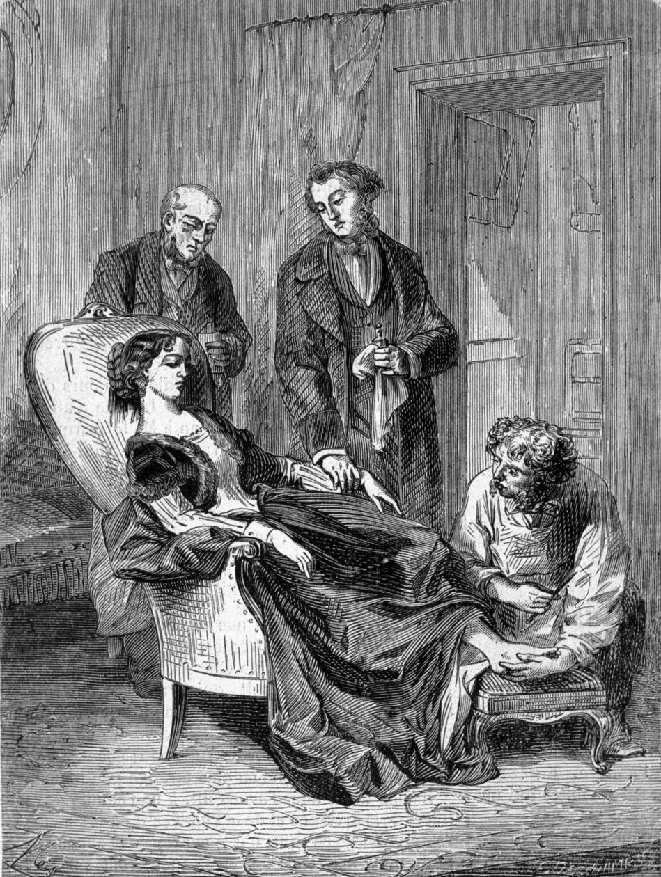28/01/1848 tarihinde ilk kloroform anestezilerinden birini takiben on beş yaşındaki Hannah Greener kızının kararları. 1869