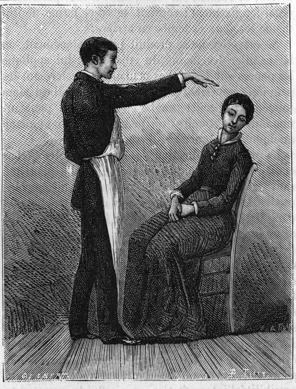 Hipnotizma fenomeni: Elin aniden hastanın önünde uzatılmasıyla hipnotizma üretilir. 1881