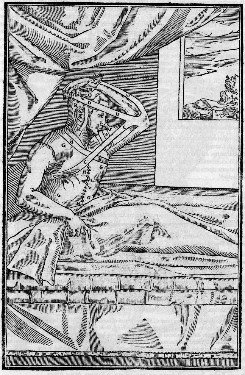 Burun cerrahisi: “De curtorum chirurgia per insitionem”de burunda rekonstrüktif cerrahi. Venedik by Unknown artist
