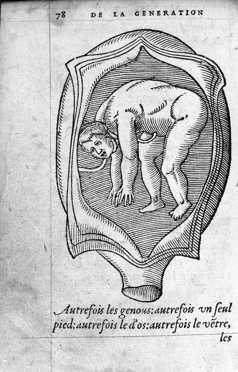 Hamilelik sırasında fetüsün rahimdeki konumu. Fransız doktor ve cerrah Ambroise Pare (1509-1590) tarafından “De la Generation des enfants”dan gravür 16. yüzyıl by Unknown artist