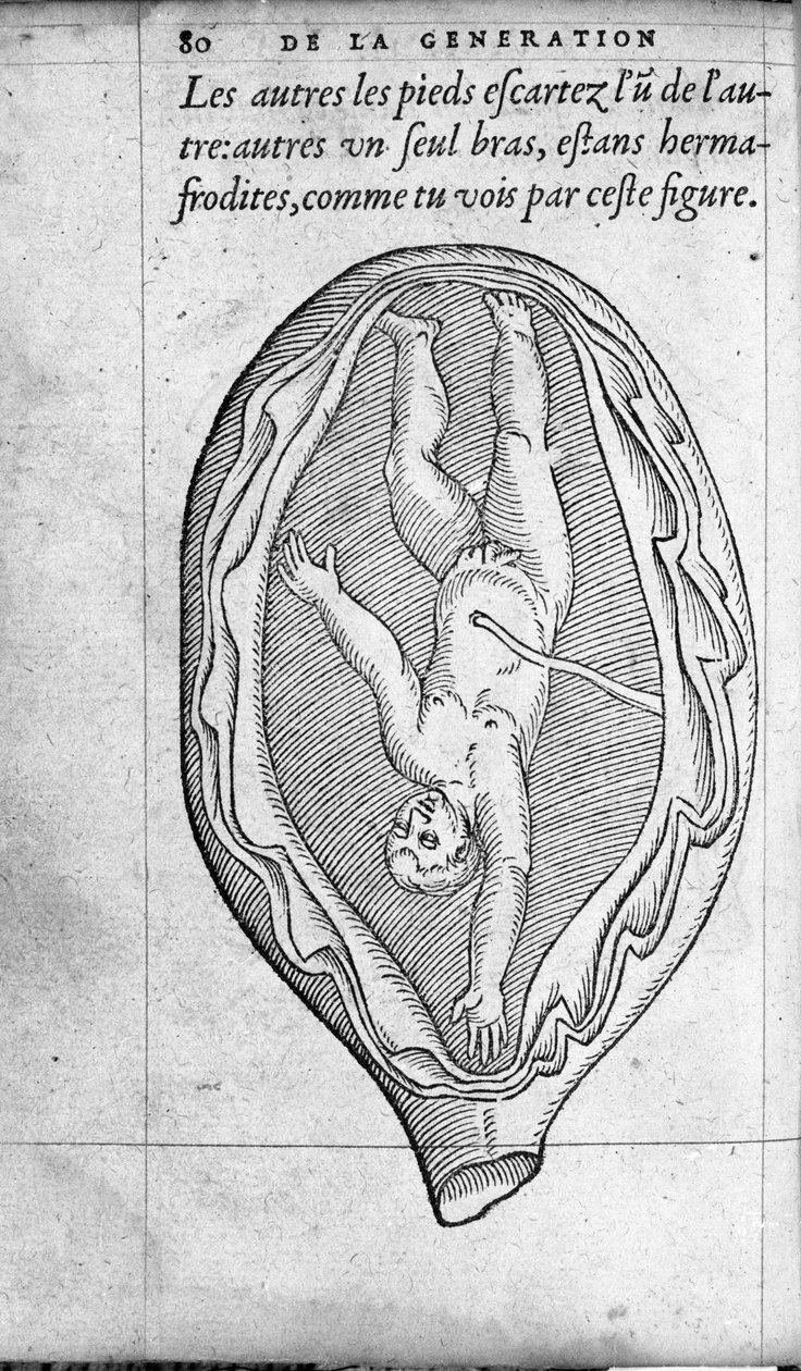Hamilelik sırasında fetüsün rahimdeki konumu. Fransız doktor ve cerrah Ambroise Pare (1509-1590) tarafından “De la Generation des enfants”dan gravür 16. yüzyıl by Unknown artist