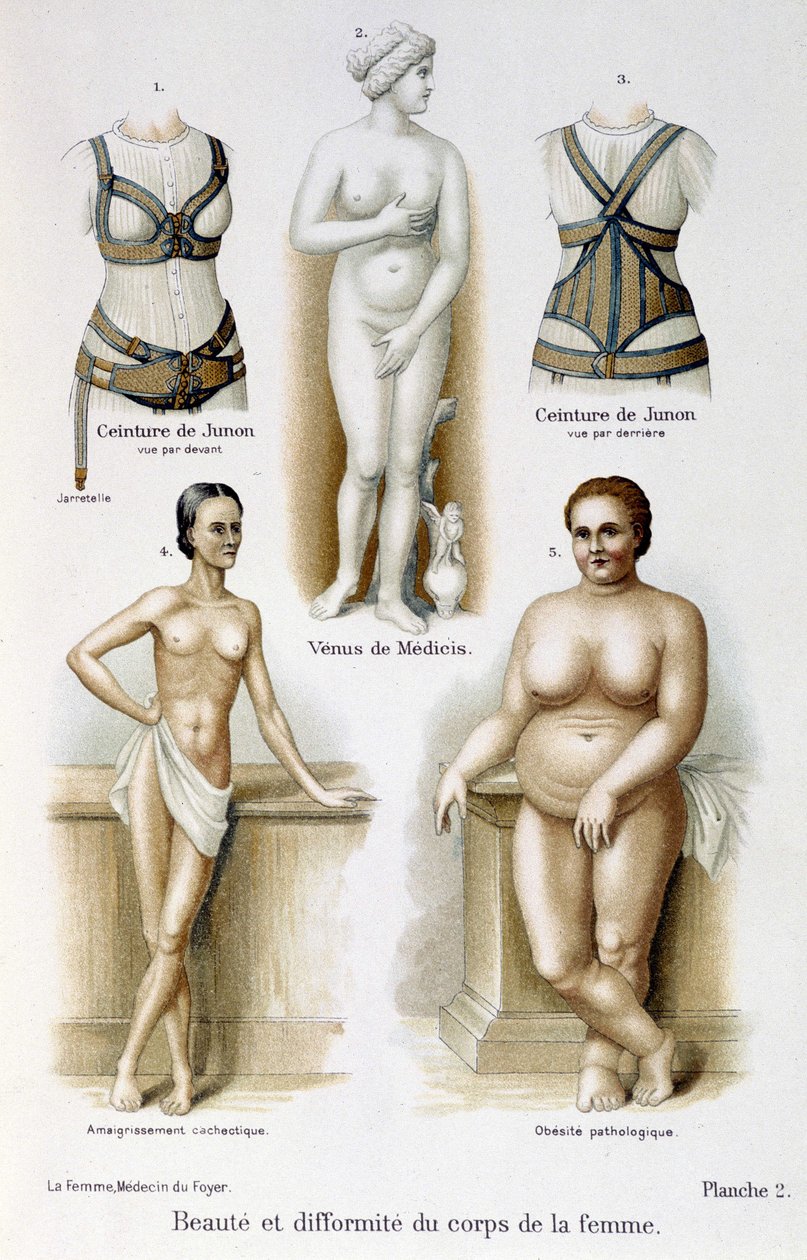 Kadın vücudunun güzelliği ve deformitesi (zayıf ve obezite); Juno