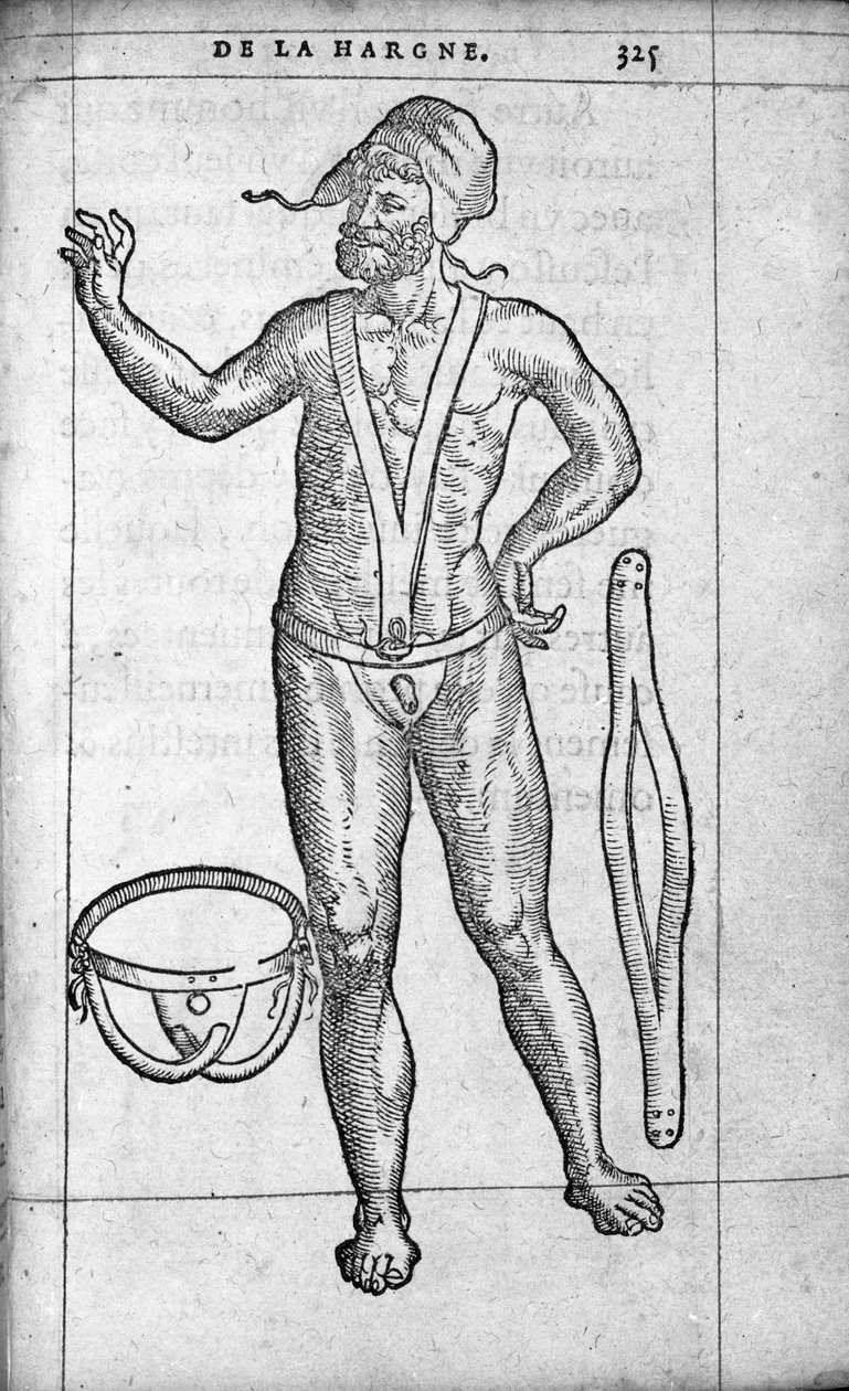 Tıp: fıtık kemeri. Fransız doktor ve cerrah Ambroise Pare (1509-1590) tarafından “De la hargne”den gravür 16. yüzyıl by Unknown artist