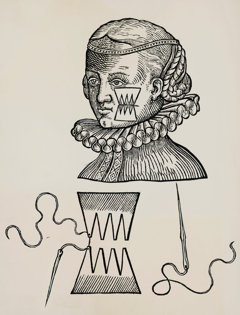 Deride dikiş izi kalmaması için yanak yarası alçı ile tedavi edilmiştir. by Unknown artist